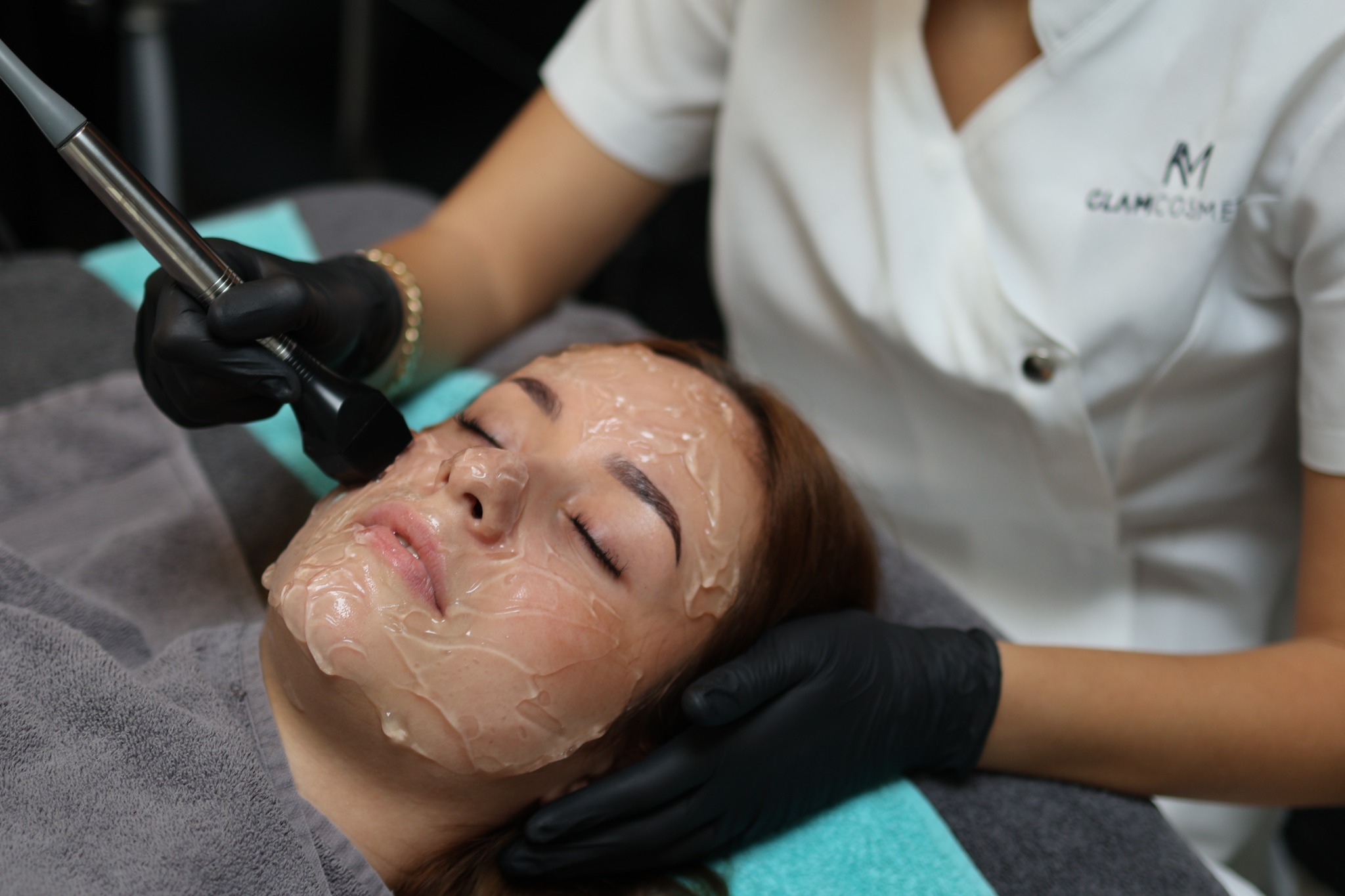 Forma-Behandlung an der Wange bei GLAMcosmetic